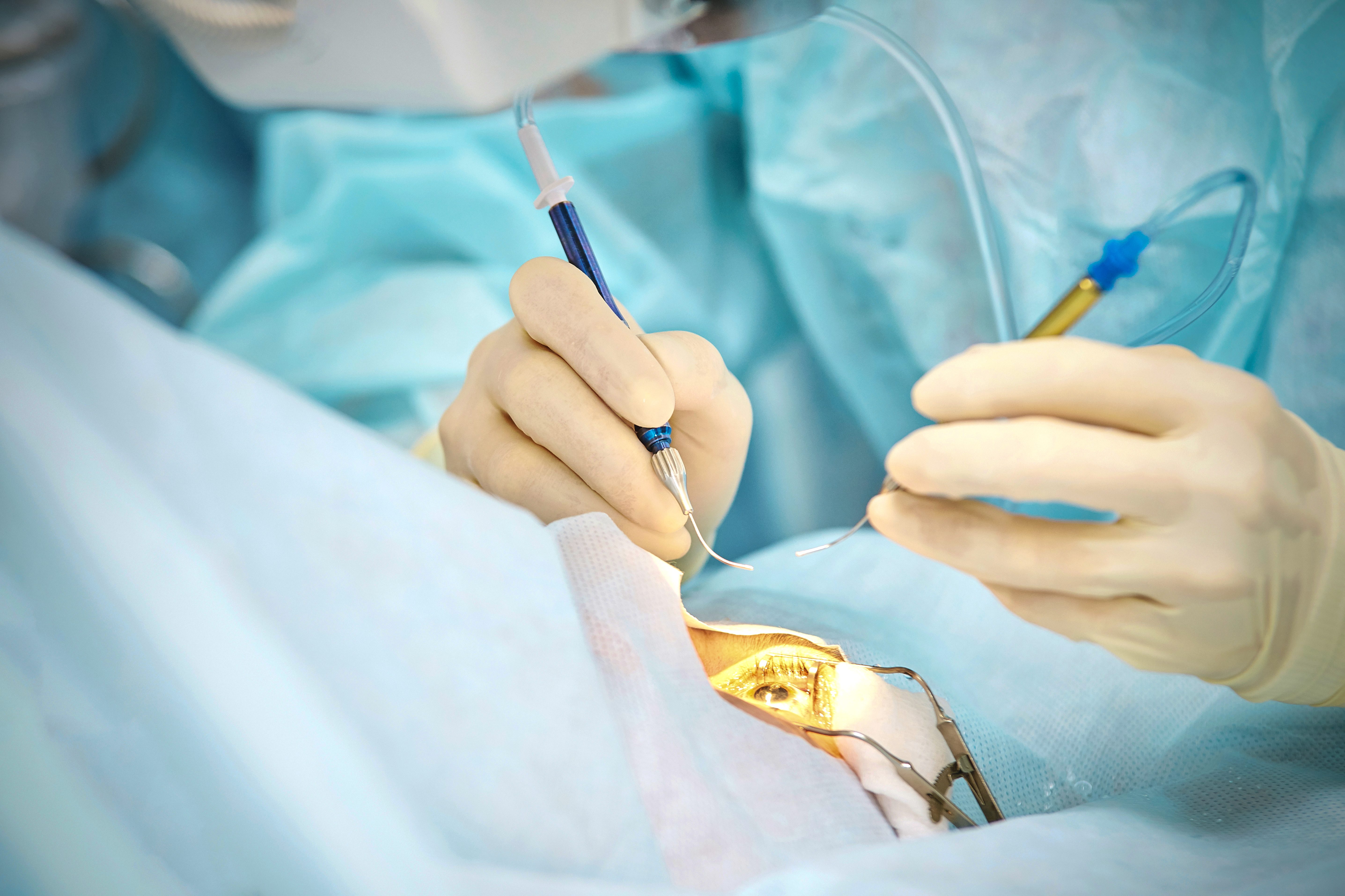 Ophthalmologie Laser-Mikroskop Betrieb. Arzt Operation in der Klinik. Behandlung der Augen von Patienten. Myopie und Kataraktentfernung. Medizinische Vision prp lasik