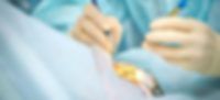 Augenoperation Patienten-Augen-Myopie-und-Katarak-Entfernung - Kunststoffinstrumente im Einsatz Ophthalmologie Laser-Mikroskop Betrieb. Arzt Operation in der Klinik. Behandlung der Augen von Patienten. Myopie und Kataraktentfernung. Medizinische Vision prp lasik