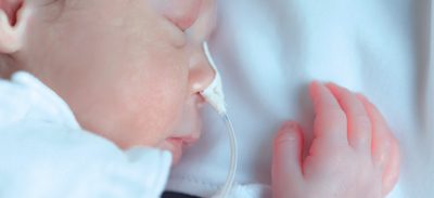 Novoplast Schlauchtechnik: Produkt Ernährungssonde